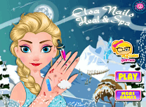 Elsa Tratament la Unghii